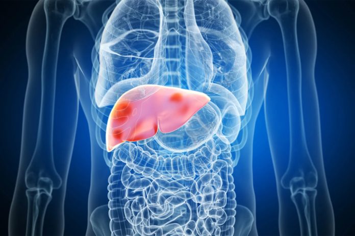 can-chatgpt-help-adults-manage-their-liver-disease?