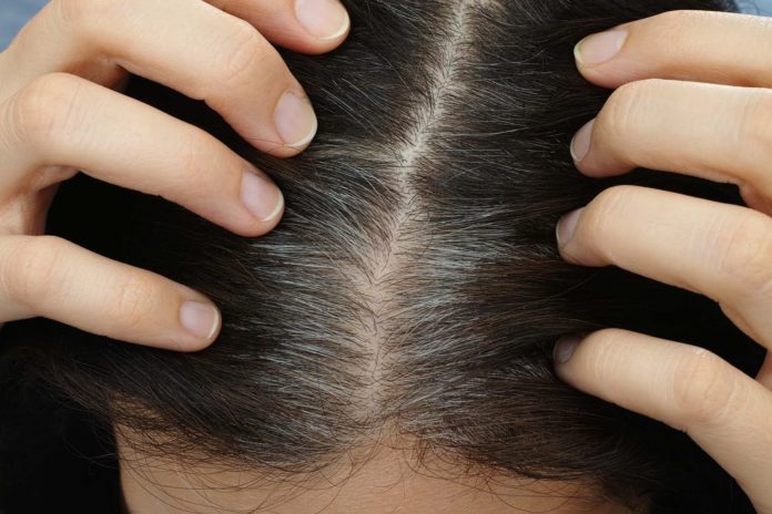gray-hair-and-aging:-could-‘stuck’-stem-cells-be-to-blame?